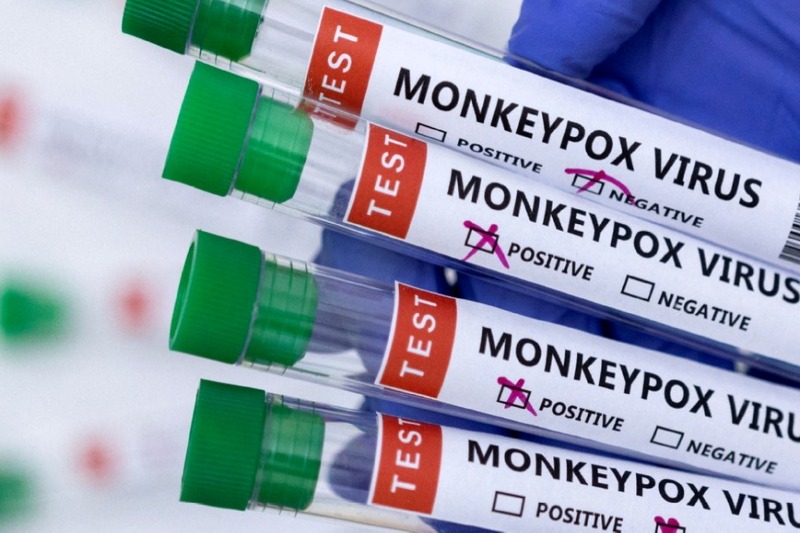  WHO reports 18,000 monkeypox cases worldwide, majority in Europe