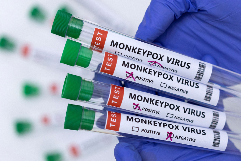 African Officials say current surge of monkeypox, an emergency