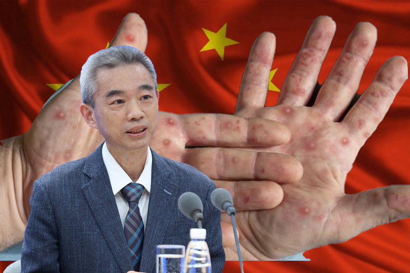 First monkeypox case detected in China, health advisory “don’t touch foreigners”