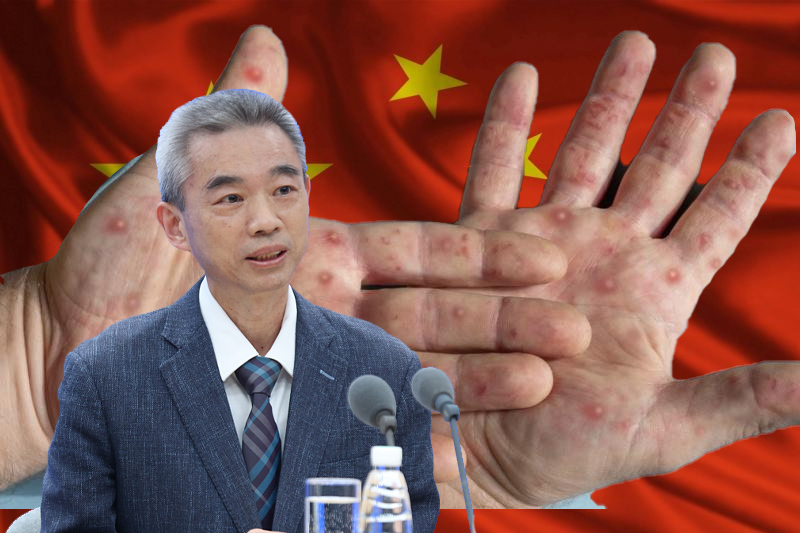 first monkeypox case detected in china health advisory dont touch foreigners