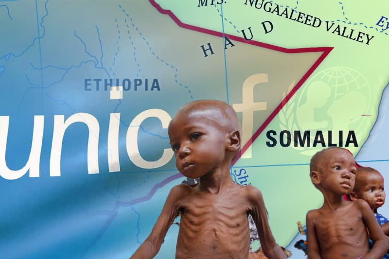  Malnutrition causing unprecedented child deaths in Somalia