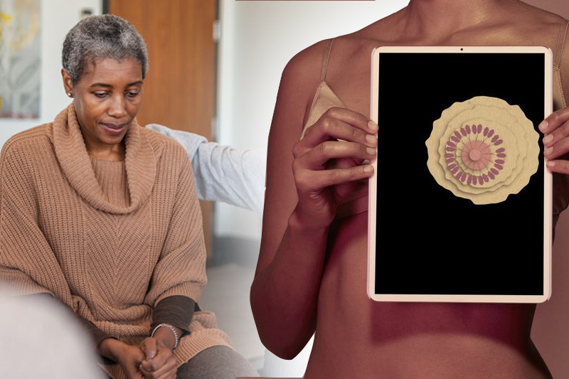  Study: Breast cancer more aggressively predominant among black women